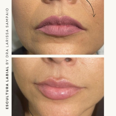 Escultura Labial